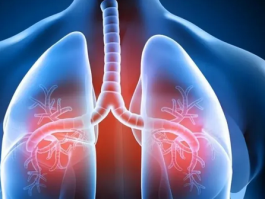 肺功能养护：警惕"三红"食物的潜在影响