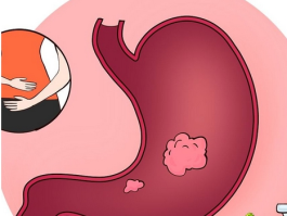 急性肠胃炎半夜自救小妙招，深夜肠胃炎自救指南